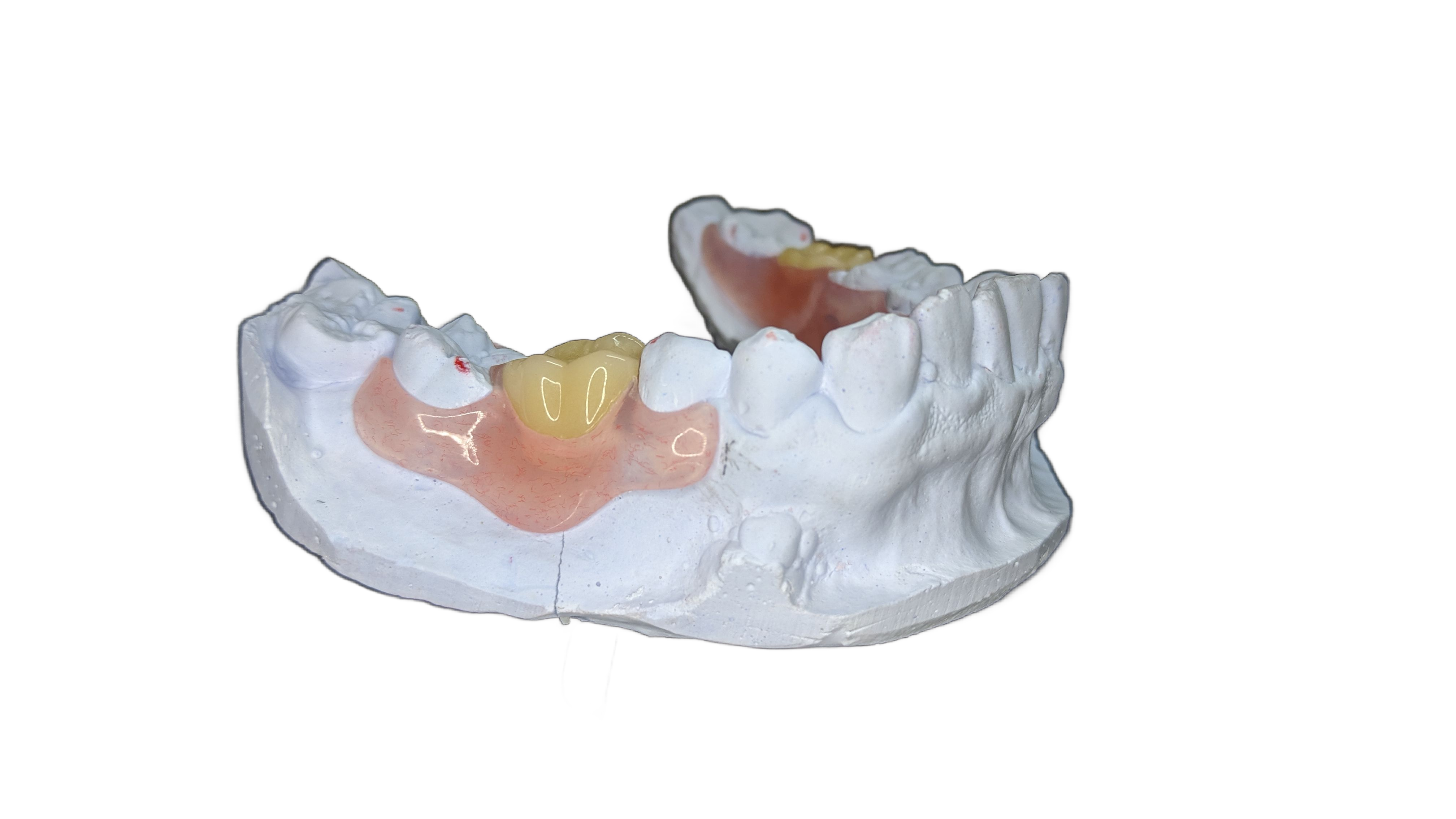 Benefits of Flipper Teeth